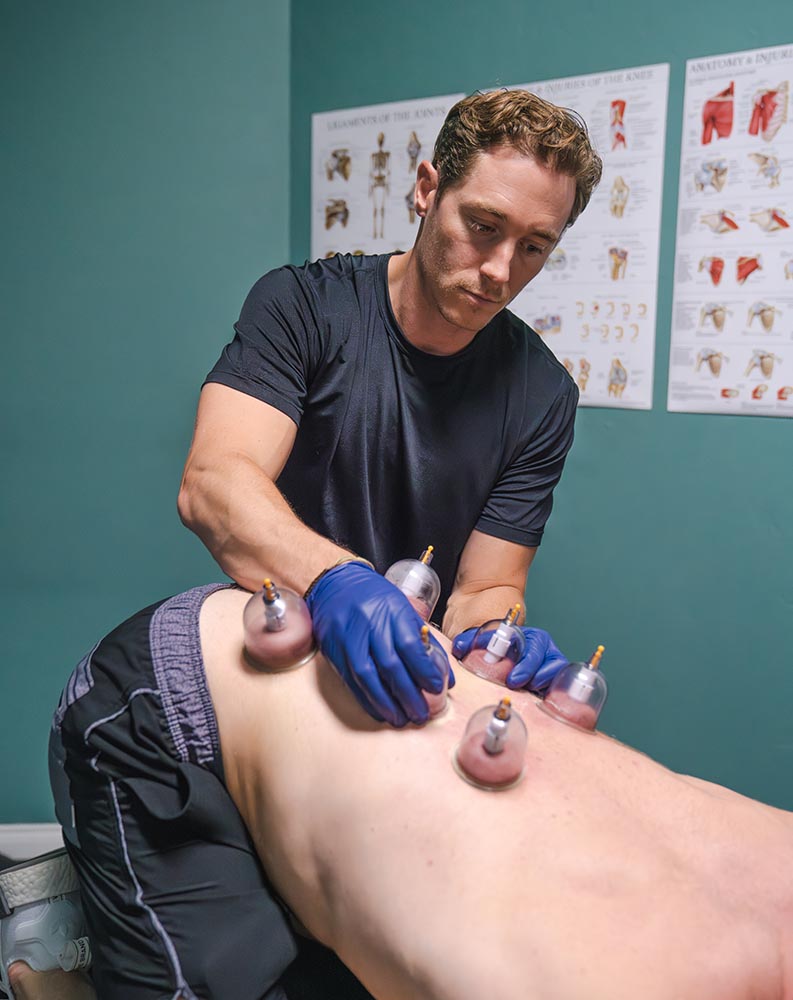 cupping back physical therapy
